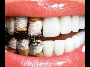 Tobacco and smoking damages teeth